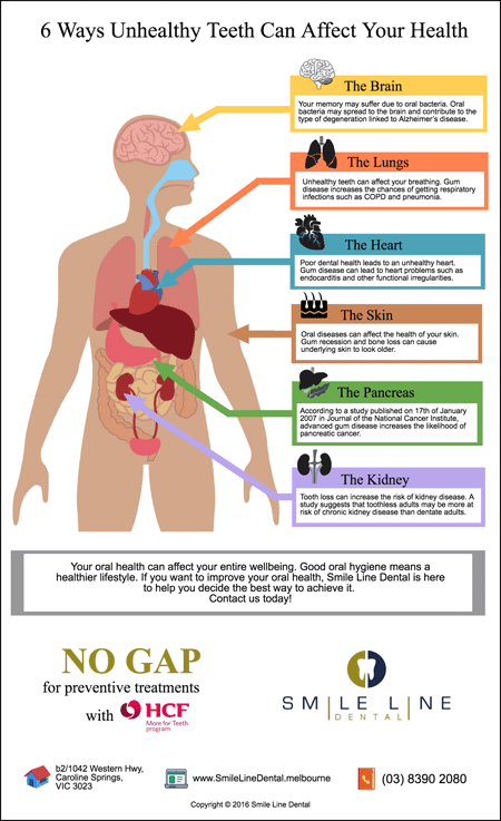 Caroline-Springs-Dentist-Trivia-6-Ways-Unhealthy-Teeth-Can-Affect-Your-Health